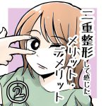 二重整形して感じたメリット・デメリット2