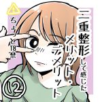 二重整形して感じたメリット・デメリット12